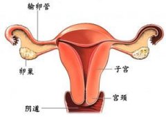 女性输卵管堵塞怎么办?