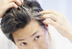 想让白发变黑发 你需要这么做